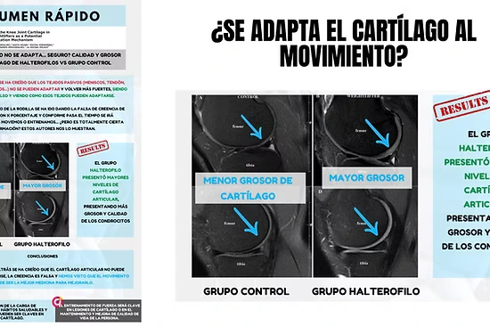 WEBINAR SOBRE CONDROMALACIA ROTULIANA PARA PACIENTES - Todo lo que debes saber. - Imagen 3